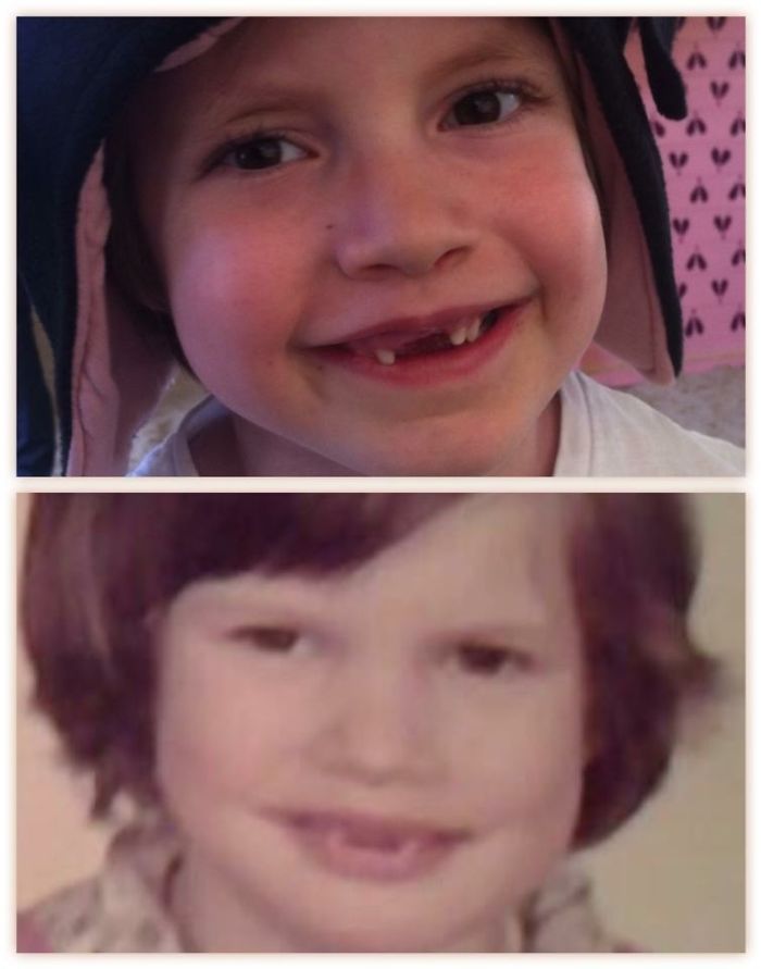 Close-up comparison showing a child and parent with similar facial features and missing front teeth proving kids copy parents.