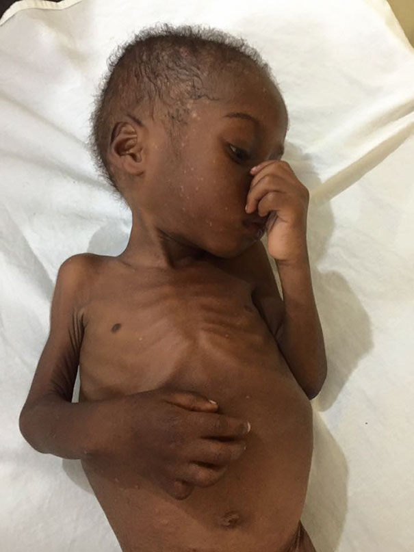 nigerian-starving-thirsty-boy-hope-rescued-anja-ringgren-loven-26 nigerian-starving-thirsty-boy-hope-rescued-anja-ringgren-loven-26
