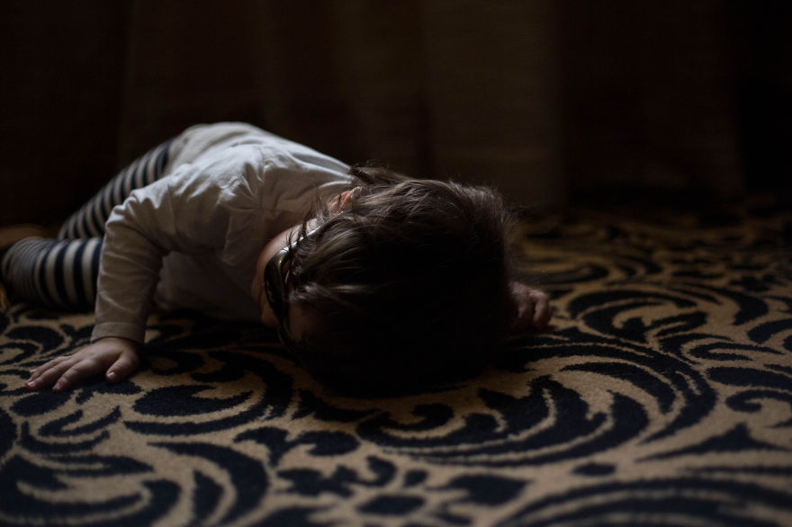 This Little Girl Has A Disease So Rare She Is The Only One To Be Diagnosed With It This Little Girl Has A Disease So Rare She Is The Only One To Be Diagnosed With It