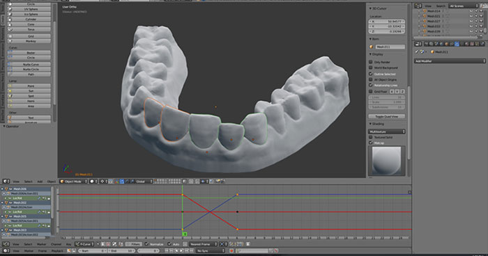 3d-printed-braces-amos-dudley-11