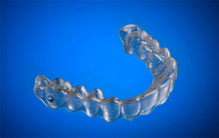 3d-printed-braces-amos-dudley-6