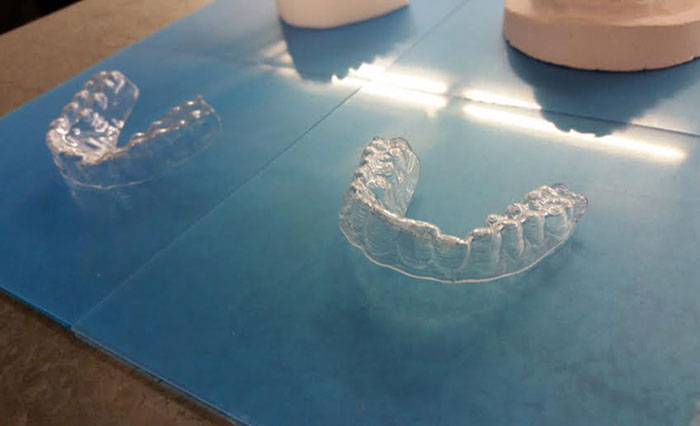 3d-printed-braces-amos-dudley-8