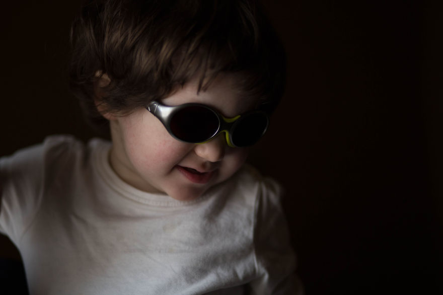 This Little Girl Has A Disease So Rare She Is The Only One To Be Diagnosed With It This Little Girl Has A Disease So Rare She Is The Only One To Be Diagnosed With It