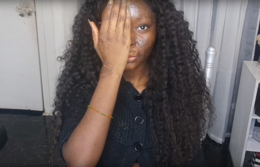 burn-victim-power-of-make-up-transformation-shalom-nchom-blac-2