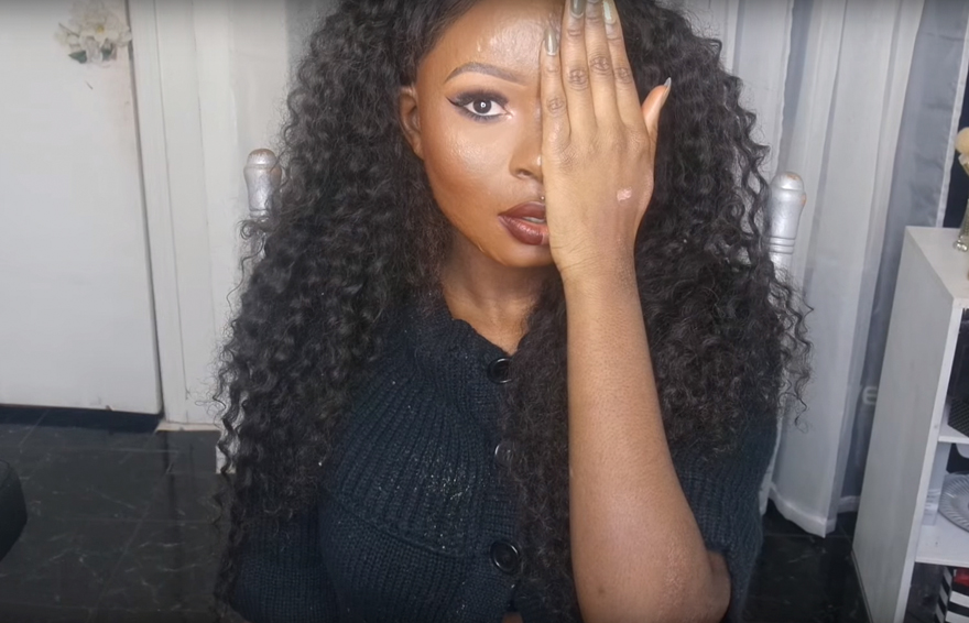 burn-victim-power-of-make-up-transformation-shalom-nchom-blac-3 burn-victim-power-of-make-up-transformation-shalom-nchom-blac-3