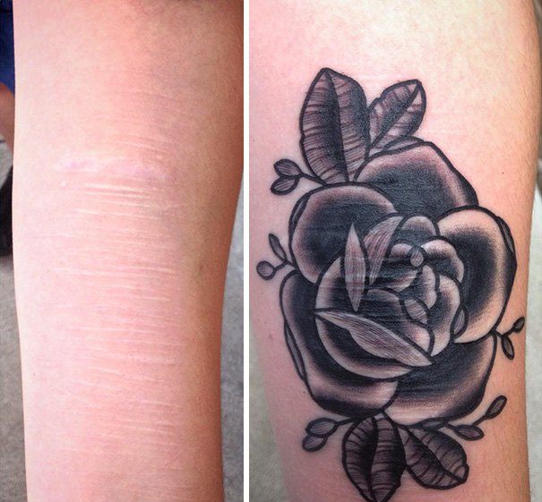 "Free cover-up tattoo on a forearm, transforming scars into a black rose design. "Free cover-up tattoo on a forearm, transforming scars into a black rose design.