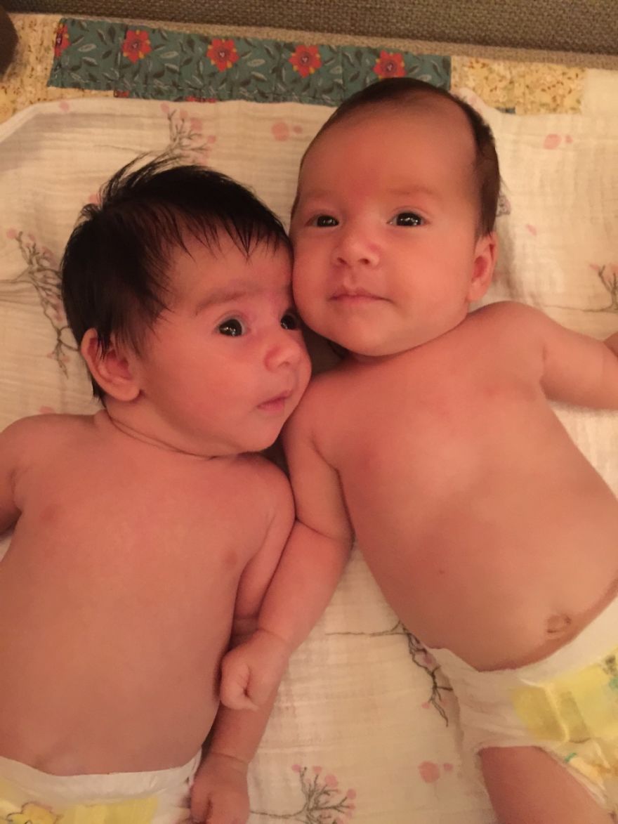 My Little Twins...one Came Hairier Than The Other!