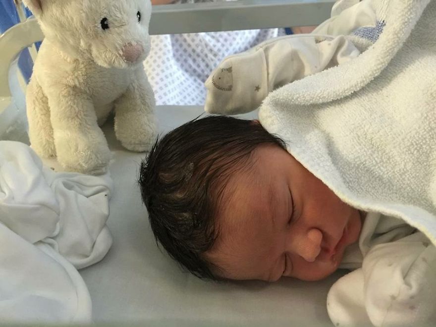 My Son Was Also Born With A Lot Of Hair