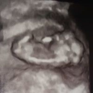 lordotring_1990 avatar