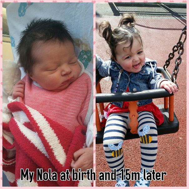 Nola With A Full Head Of Hair At Birth And Now Aged 15 Months
