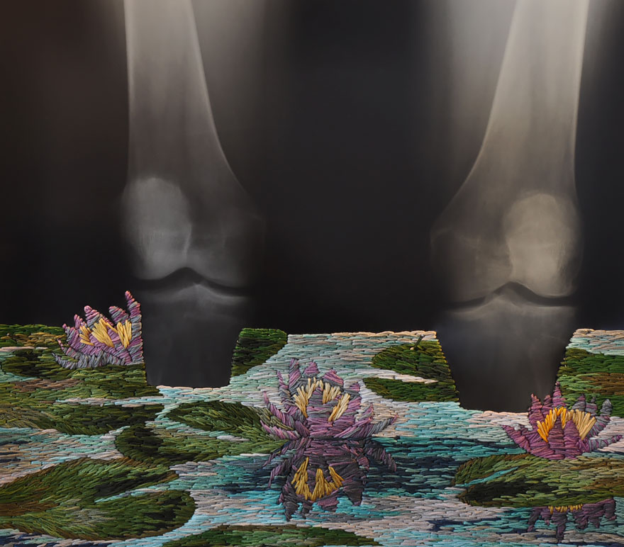 Embroidered X-ray Film By Matthew Cox