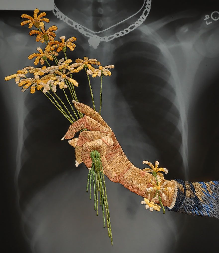Embroidered X-ray Film By Matthew Cox
