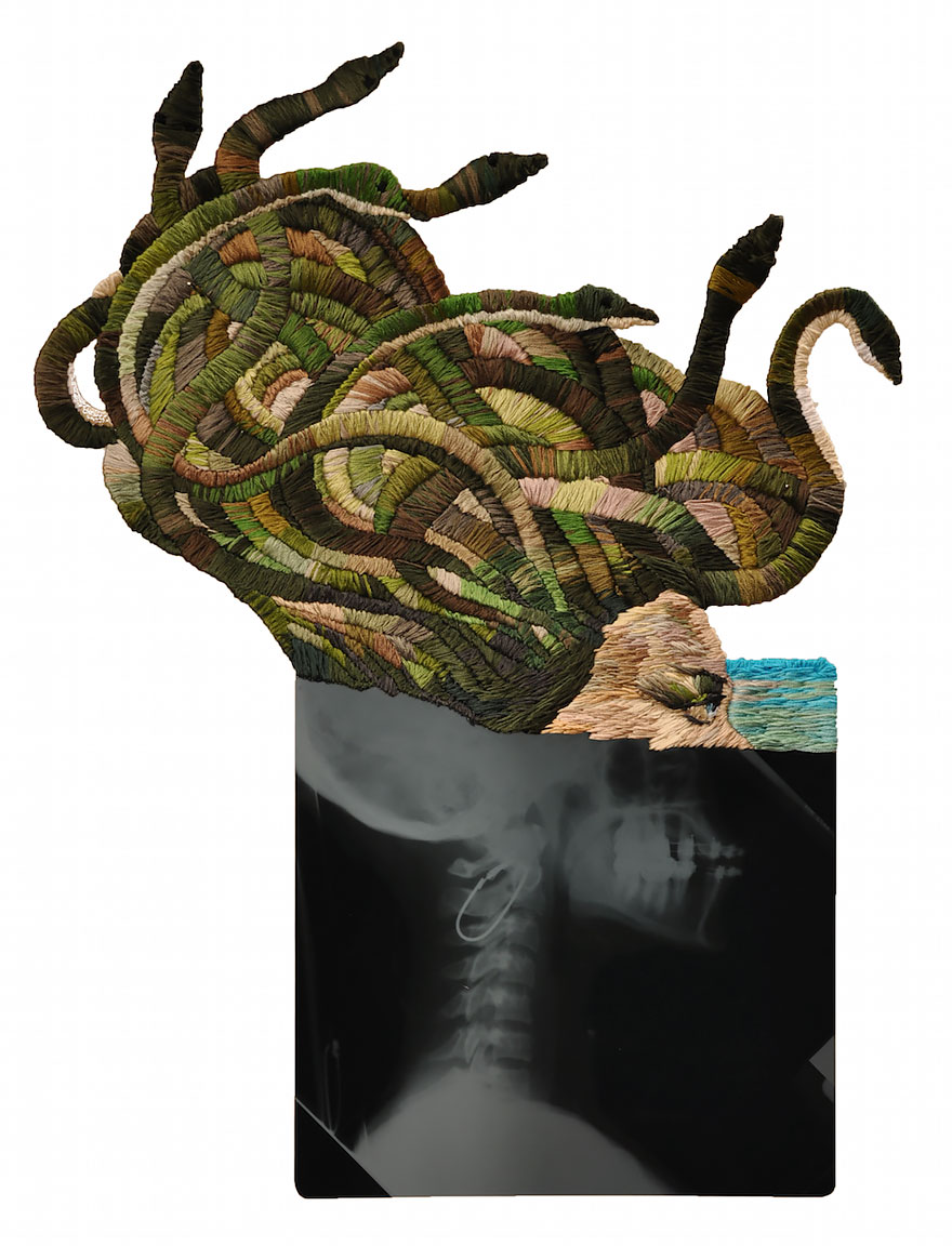 Embroidered X-ray Film By Matthew Cox