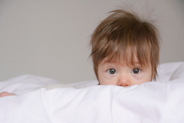 Florens Came To The World With Hair And The First Thing The Nurse Said Was “she’s Hairy”