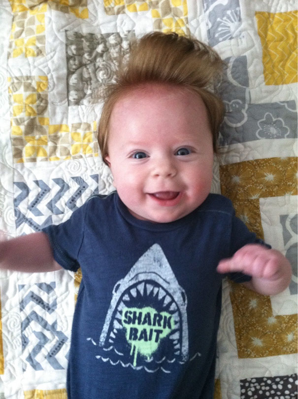 My Friend's Baby Was Also Born With Conan Hair