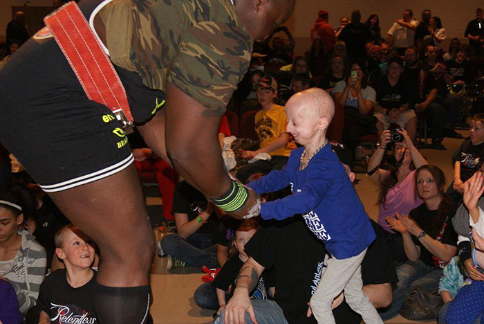 girl-rare-disease-progeria-powerlifter-friendship-lindsay-ratcliffe-david-douglas-3