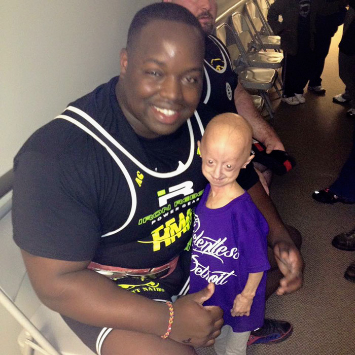 girl-rare-disease-progeria-powerlifter-friendship-lindsay-ratcliffe-david-douglas-4