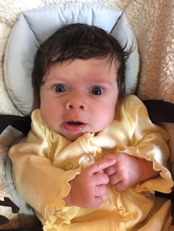 All This Hair I Should Be 7 Years Old Not 7 Weeks!