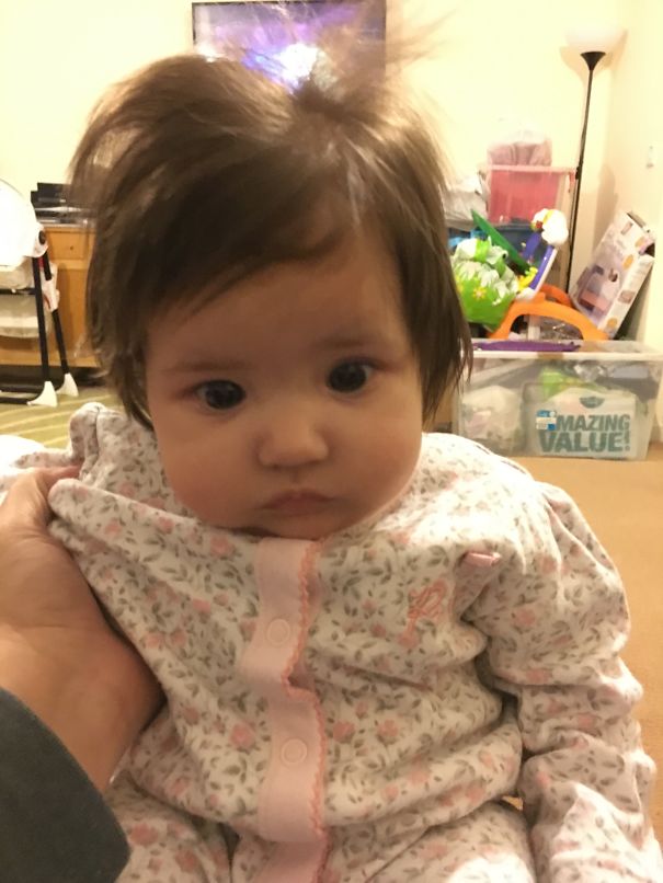 Willow At 8 Weeks Born With Full Head Of Hair