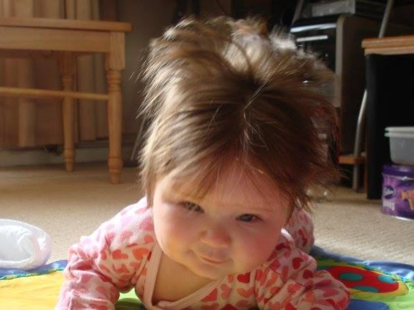 This Is Eden Willow, Sporting The Pineapple Look