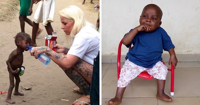 2-Year-Old ‘Witch Child’ Who Was Left To Die Makes Stunning Recovery