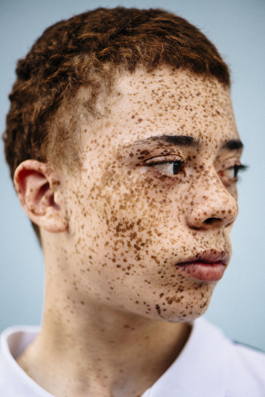 Photographer Documents The Beautiful Diversity Of Redhead People Of Color Photographer Documents The Beautiful Diversity Of Redhead People Of Color