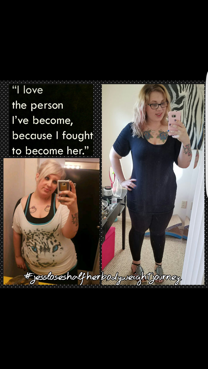 Start Weight 360 Current 238 Goal 170 Pending Tummy Tuck