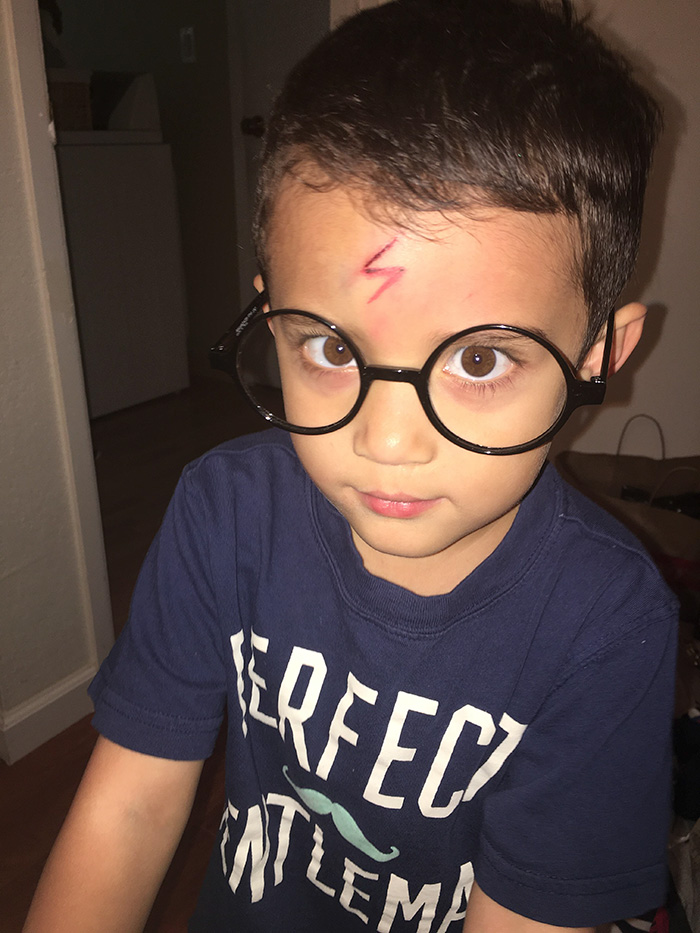 mom-turns-kid-scar-into-harry-potter-lightning-sign-2 mom-turns-kid-scar-into-harry-potter-lightning-sign-2