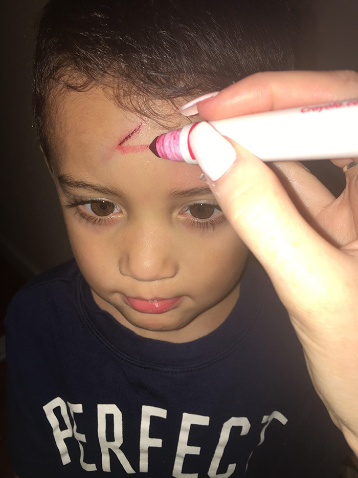 mom-turns-kid-scar-into-harry-potter-lightning-sign-6 mom-turns-kid-scar-into-harry-potter-lightning-sign-6