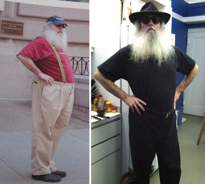 Before And After Weight Loss