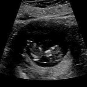 yolandasaavedra80 avatar