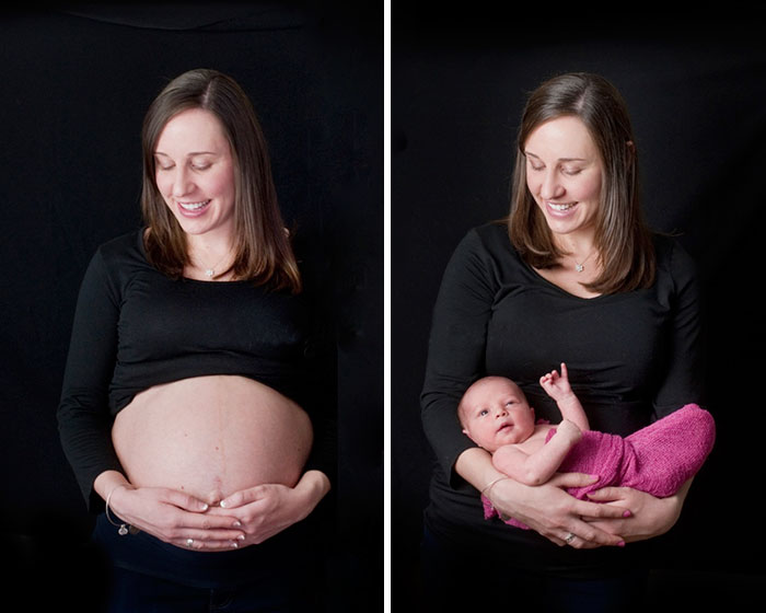 Before And After Birth