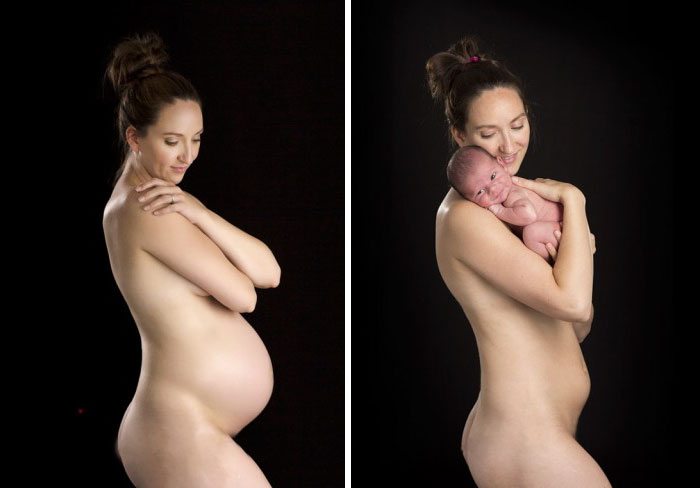 Before And After Birth