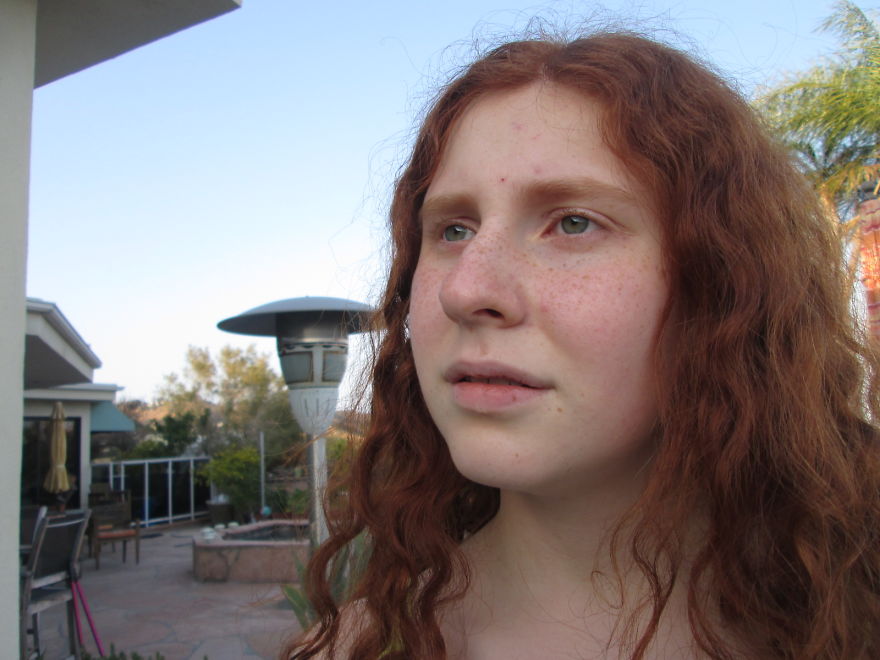 I Photographed My Older Sister To Show The Beauty Of Her Disability I Photographed My Older Sister To Show The Beauty Of Her Disability