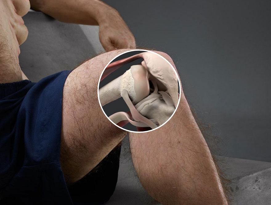 graham-body-survive-car-crash-road-safety-victorian-government-patricia-piccinini-23 graham-body-survive-car-crash-road-safety-victorian-government-patricia-piccinini-23