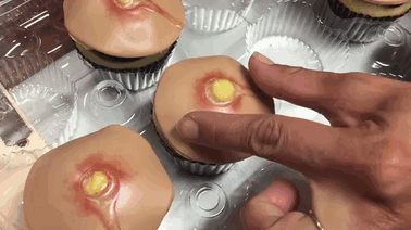 pimple-cupcakes-dr-pimple-popper-blessed-by-baking-3 pimple-cupcakes-dr-pimple-popper-blessed-by-baking-3