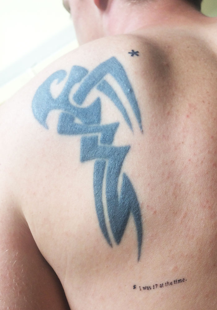 Creative cover-up tattoo featuring abstract design on back shoulder, next to small text reading "I was 17 at the time."