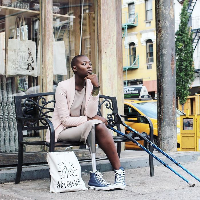 Amputee Woman Who Was Given 3 Weeks To Live Becomes Famous Fashion Blogger Amputee Woman Who Was Given 3 Weeks To Live Becomes Famous Fashion Blogger