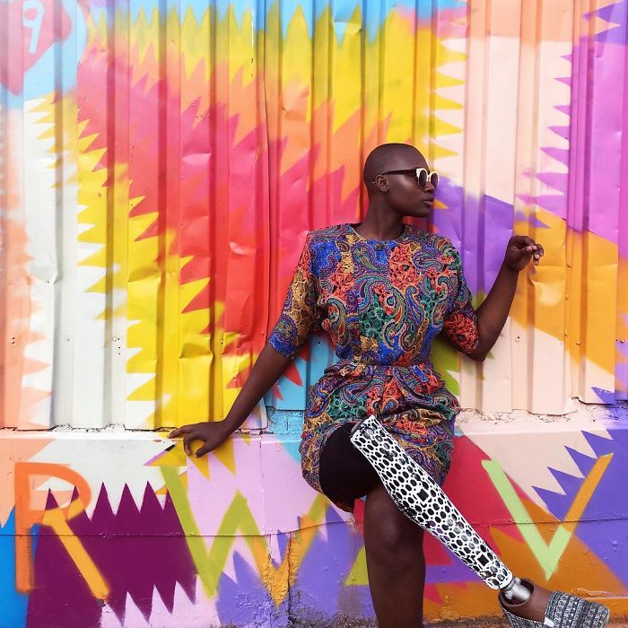 Amputee Woman Who Was Given 3 Weeks To Live Becomes Famous Fashion Blogger Amputee Woman Who Was Given 3 Weeks To Live Becomes Famous Fashion Blogger