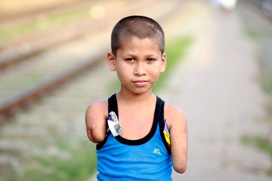 The Worth Of Potato Chips