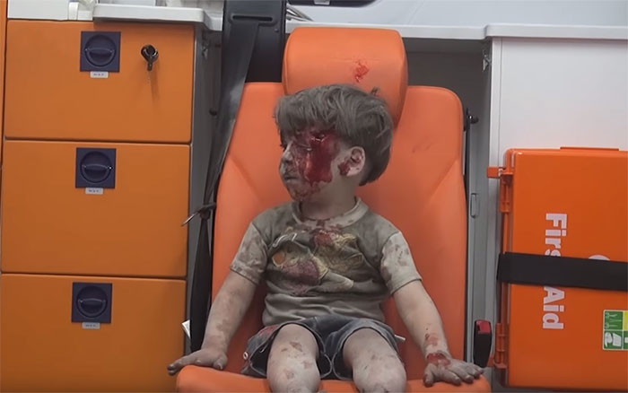 alleppo-boy-air-strike-syria-omran-daqneesh-5 alleppo-boy-air-strike-syria-omran-daqneesh-5