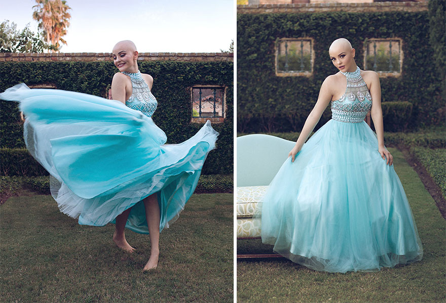 bald-teen-cancer-photoshoot-andrea-sierra-salazar-gerardo-garmendia-42 bald-teen-cancer-photoshoot-andrea-sierra-salazar-gerardo-garmendia-42