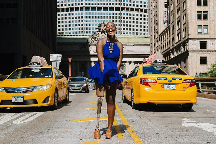 Amputee Woman Who Was Given 3 Weeks To Live Becomes Famous Fashion Blogger