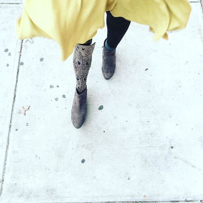 Amputee Woman Who Was Given 3 Weeks To Live Becomes Famous Fashion Blogger Amputee Woman Who Was Given 3 Weeks To Live Becomes Famous Fashion Blogger