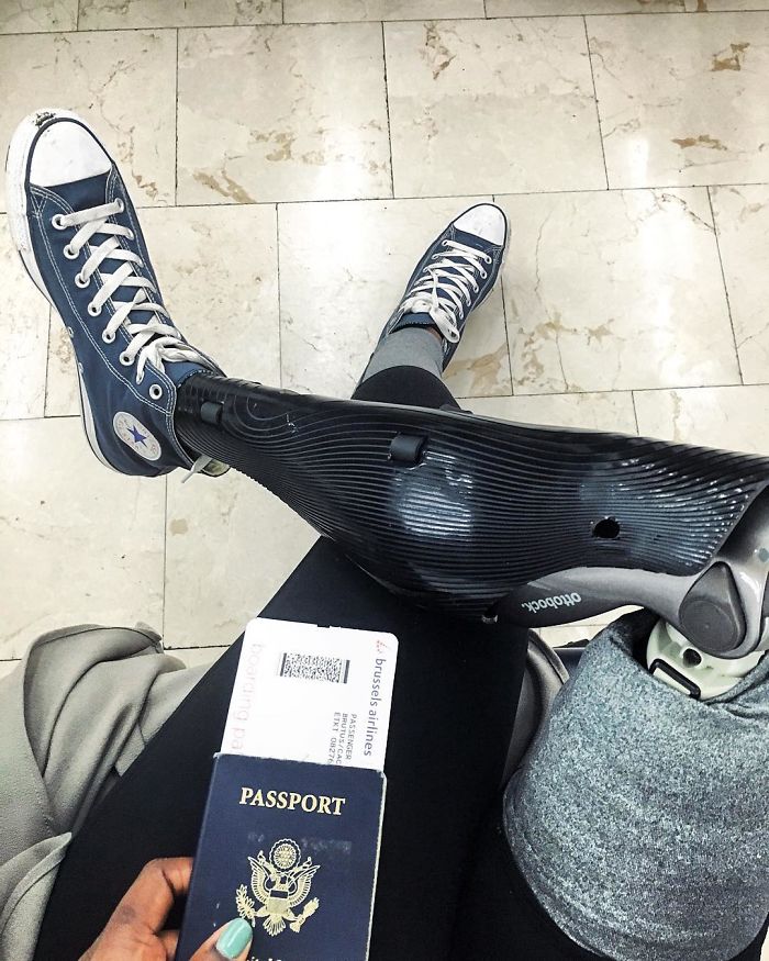 Amputee Woman Who Was Given 3 Weeks To Live Becomes Famous Fashion Blogger