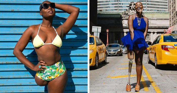 Amputee Woman Who Was Given 3 Weeks To Live Becomes Famous Fashion Blogger