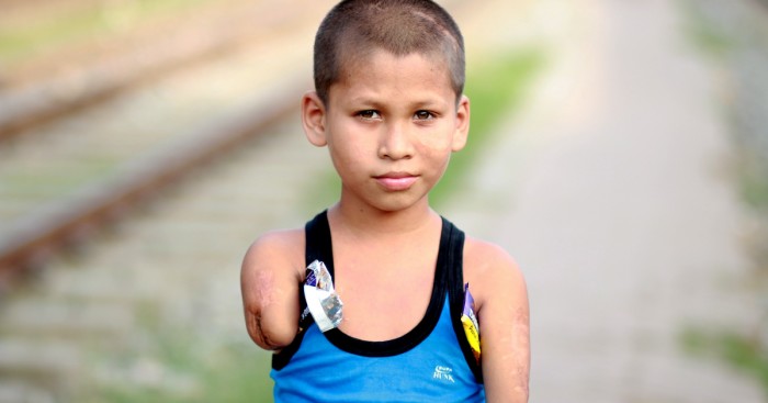 The Worth Of Potato Chips