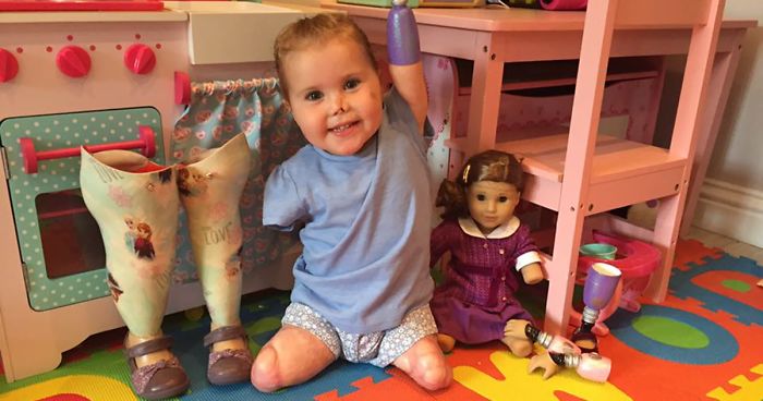 2-Year-Old Girl Gets Quadruple Amputee Doll That Looks Just Like Her