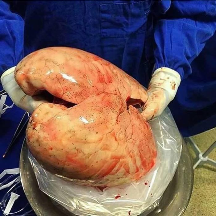 Human Body , Like Never Before ! (+20 Amazing Photos) Human Body , Like Never Before ! (+20 Amazing Photos)