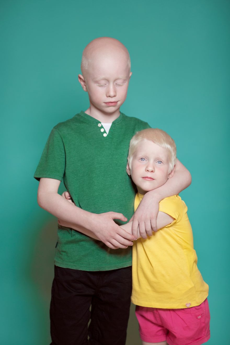 We Took Photographs Of Albino Kids To Show Their Pure Beauty We Took Photographs Of Albino Kids To Show Their Pure Beauty